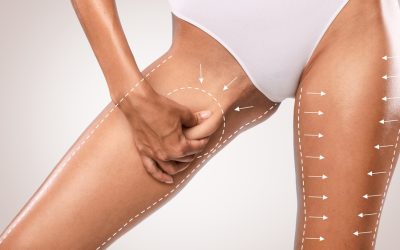 How can I tone my inner thighs?